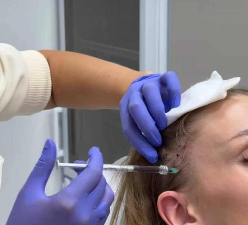 «Выпали волосы»: популярная блогерша «Ботановна» рассказала о последствиях пластики 