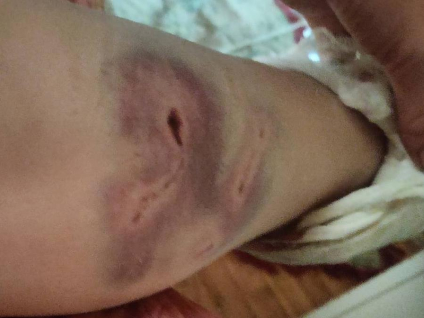 СК расследует нападение бродячей собаки в Воронеже