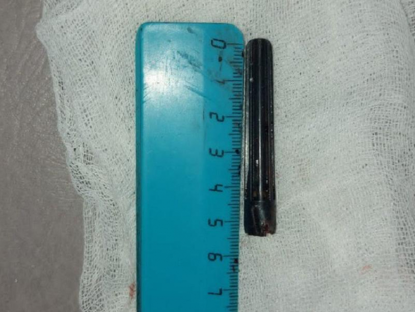 Подавившегося колпачком пятилетнего мальчика спасли врачи в Воронеже