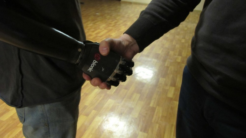 Воронежскому фаерщику, лишившемуся рук, установили протезы 