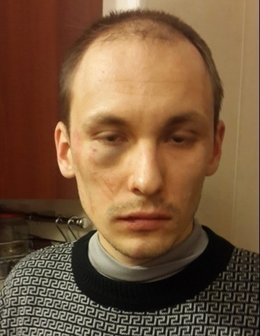 В Воронеже избит лидер местного отделения «Справедливой России» в Новоусманском районе
