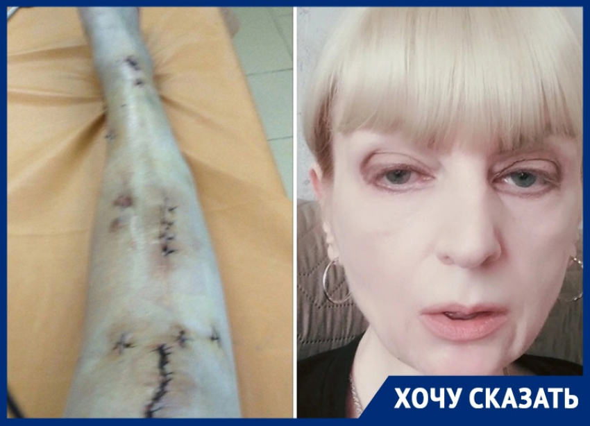 «У меня украли жизнь»: женщина-инвалид обратилась к Бастрыкину после череды операций в Воронеже 