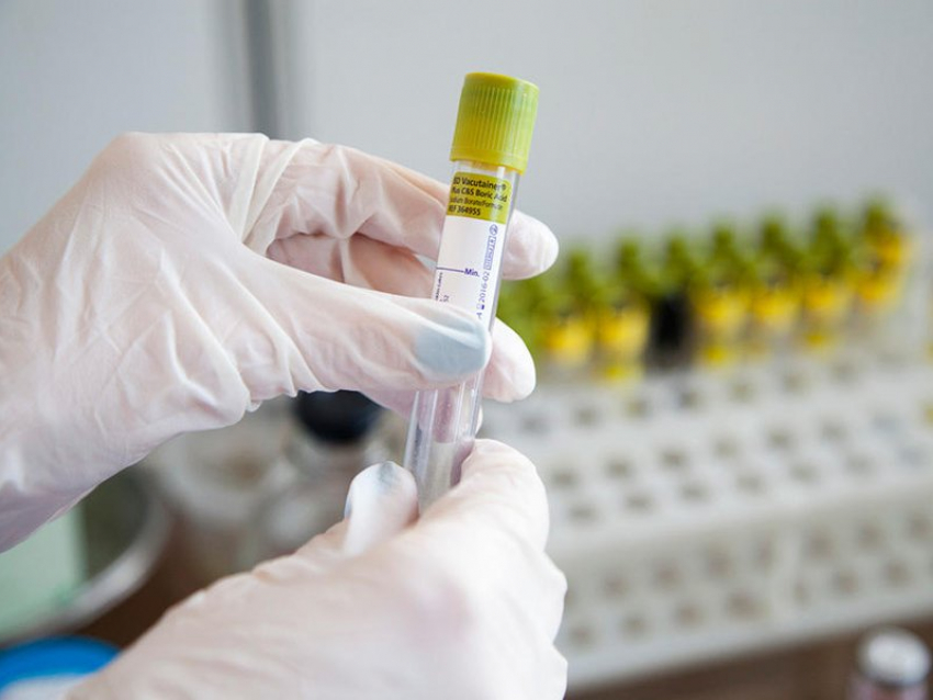 У 91 человека за сутки выявили коронавирус в Воронежской области