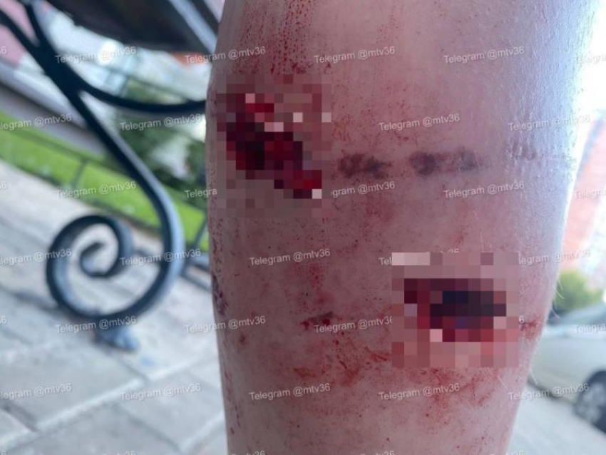 Бешеных псов, набросившихся на девушек в воронежском ЖК, не смогли отловить