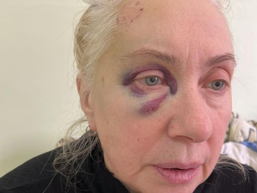 Неадекватный мужчина ворвался в палату и покусал пациентку ковидного отделения в Воронеже