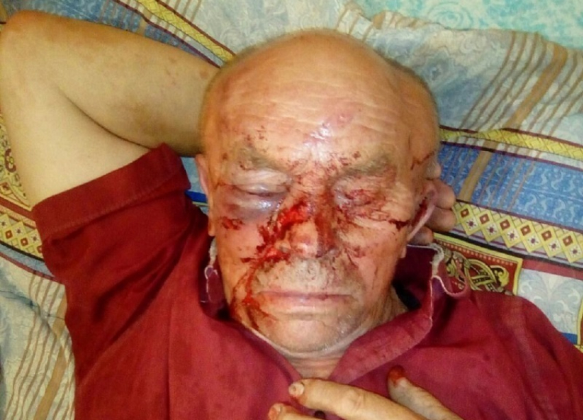 76-летнего инвалида варварски избил односельчанин в Воронежской области