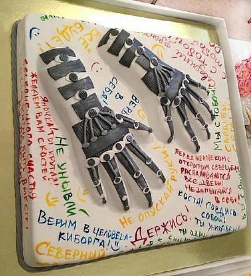 В Воронеже пройдет шоу в поддержку фаерщика, лишившегося кистей рук 