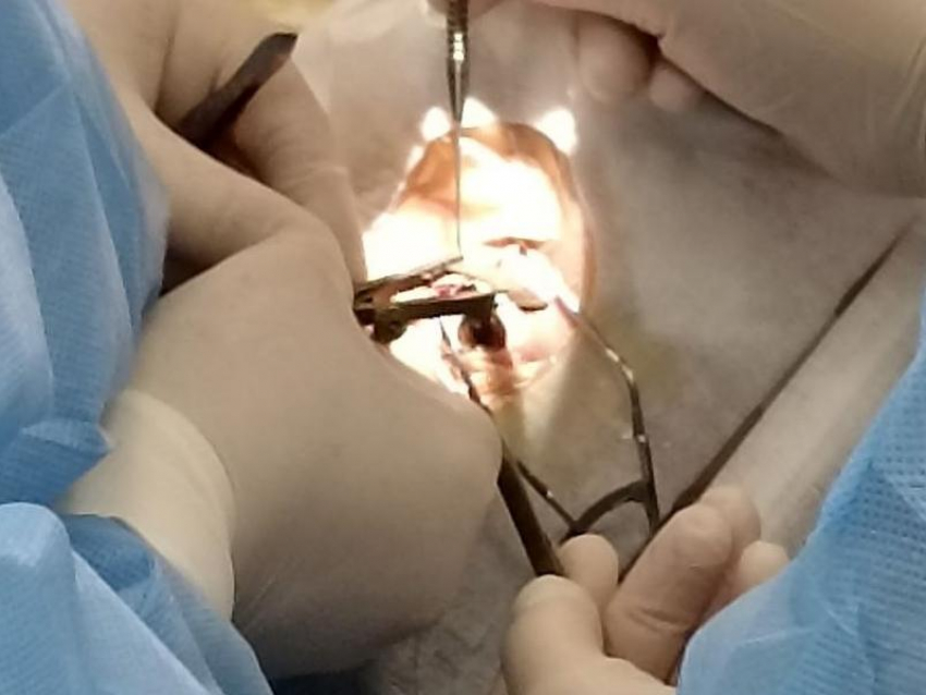 Мужчину, более 20 лет страдавшего косоглазием, вылечили в Воронеже