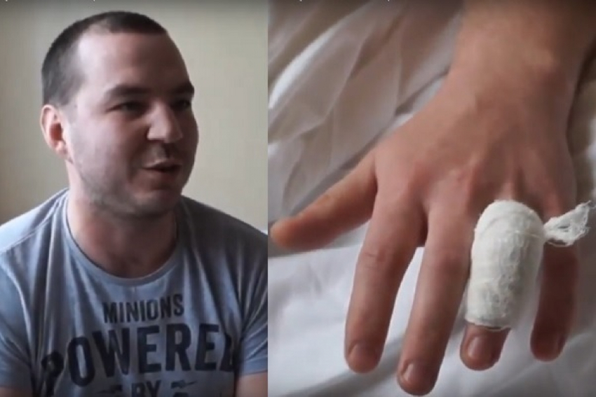 Активисту «Единой России» сделали прививку от укуса воронежских сторонников Навального