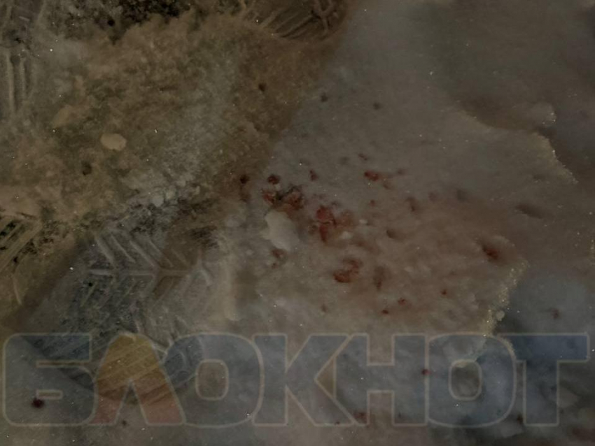 «Ему оказывают помощь»: минздрав рассказал о состоянии пенсионера, избитого битами в Воронеже