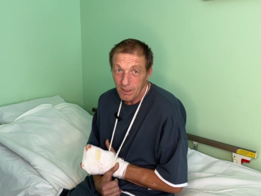 «Был шок»: воронежец ампутировал себе руку, но медики сотворили чудо