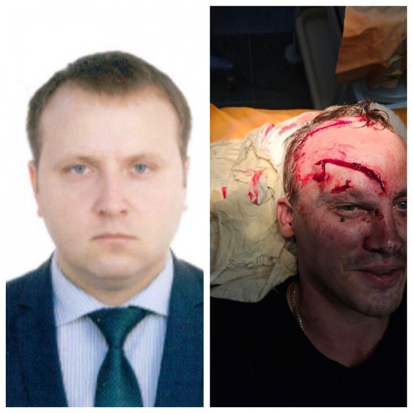 “Я тебя буду резать”: директора воронежского колледжа обвинили в поножовщине