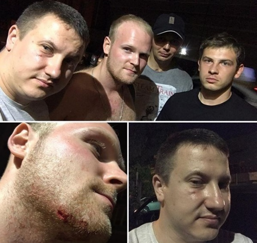 Главного дорожного активиста Вадима Серова сильно избили ночью в Воронеже