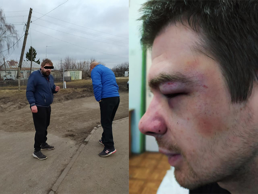 Воронежец, обвиненный в жестоком избиении мужчины на глазах у детей, заявил о клевете