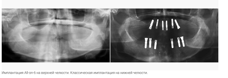 врн2.jpg